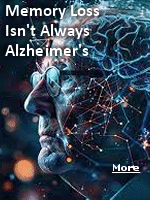 As Alzheimer's disease is the most common form of dementia,  affecting an estimated 6.7 million Americans , so it's not surprising that people who experience memory loss may suspect AD. In fact, there is another common cognitive disorder with very similar symptoms, called limbic-predominant age-related TDP-43 encephalopathy, or LATE for short, that is often misdiagnosed as Alzheimer's.